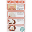 SUMIKKOGURASHI RICE MOLD